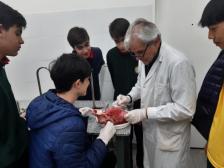 Nivel Secundaria · Disección de Pulmón